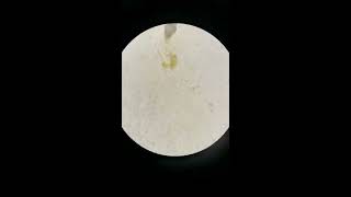 Strongyloides stercolaris en microscopio [upl. by Swetiana]