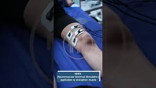 NMES NEUROMUSCULAR ELECTIRICAL STIMULATION [upl. by Einamrej]