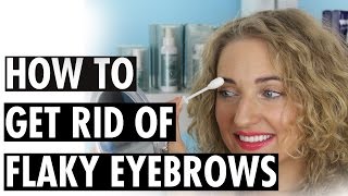 How to Get Rid of Flaky Eyebrows [upl. by Nyraf926]