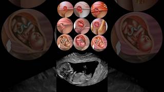 Fetal Development Month by Month😍 [upl. by Alyce4]