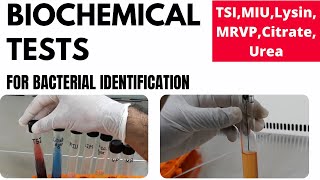 Biochemical Tests for Bacterial Identification Part1TSI MIU MRVP Lysin Urea Citrate [upl. by Nepean]