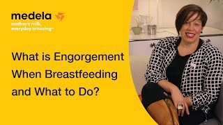 What to do if your breasts are engorged [upl. by Salomi]