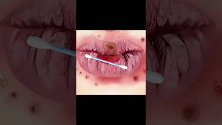 Asmr treatment for lip car asmr shortsvideo satisfying skintransformation animation [upl. by Eslek219]