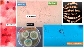 Aspergillus fumigatus Isolated from clinical specimen [upl. by Fadiman]