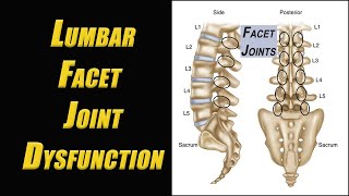 Get Rid of Low Back Pain with 3 Excellent Exercises to Treat Lumbar Facet Joint Dysfunction [upl. by Emery575]