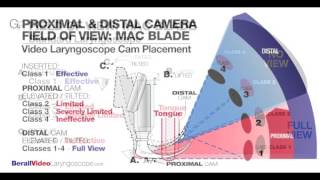 Intro to Video Laryngoscopy [upl. by Telrats]