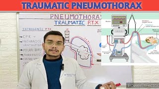 Traumatic pneumothorax pathophysiology in Hindi Iatrogenic non Iatrogenic  pneumothorax [upl. by Buehrer]