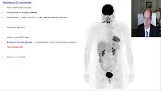 What does a PET scan look like [upl. by Aduhey364]