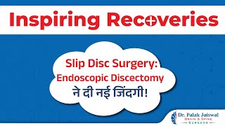 L5S1 PIVD Recovery  A Minimally Invasive Success Story  Dr Palak Jaiswal [upl. by Chui504]