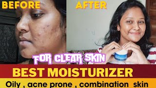 Acne to clear skin ✨️  How to get rid of acne and dark spots skincare products acneacneproneskin [upl. by Ymer]