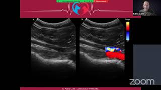 Webinar Ecocardiografia Doppler Veterinaria [upl. by Duester]