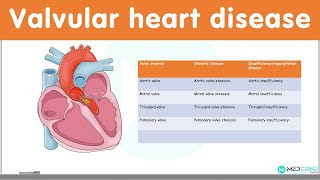 Valvular Heart Diseases Classification Causes Pathophysiology Diagnosis and Treatment [upl. by Marilyn664]