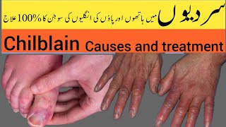 chilblain on fingers  انگلیوں کی سوجن  health really matters [upl. by Nitsug683]