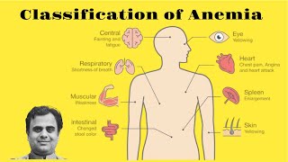 Classification of Anemia [upl. by Rosalee]