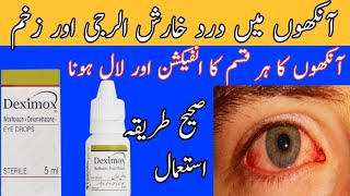 Deximox eye drops uses in UrdumoxifloxacinDexamethasoneeye infectionantibiotics drop [upl. by Nuahsed]