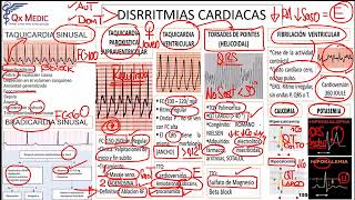 ARRITMIAS CARDIACAS [upl. by Corron90]