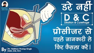 DampC Dilation and Curettage in Hindi  Miscarriage  Abortion  Unwanted Pregnancy [upl. by Algar]