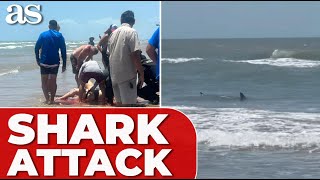 SHARK ATTACK in Texas DESTROYS womans leg leaves her hospitalized [upl. by Airednaxela]