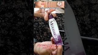 mederma advanced plus scar gel review amp demobest cream for scarhow to remove acne scars treatment [upl. by Jeniffer]