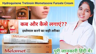 Hydroquinone tretinoin mometasone furoate cream  Melamet Cream Ki Jankari  Drx Pranjali Satpute [upl. by Audrey249]