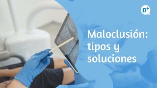 ¿Qué son las maloclusiones dentales  Dr Fernando Loscos Morato  Especialista en Estomatología [upl. by Silvain]