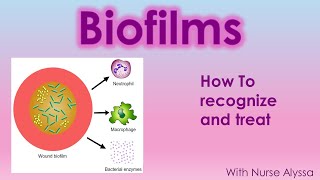 Biofilms  How to recognize and treat [upl. by Voccola]