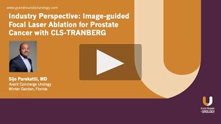 Industry Perspective Imageguided Focal Laser Ablation for Prostate Cancer with CLSTRANBERG [upl. by Cutler355]