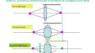 potere diottrico occhio umano [upl. by Trudy]