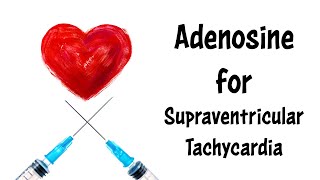 Adenosine for Supraventricular Tachycardia SVT A Basic Tutorial [upl. by Rolfe673]