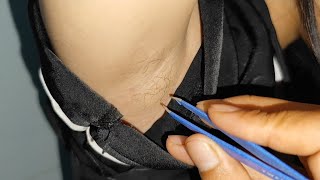 pull out underarm hair removal for ms Mai khôi asmr [upl. by Immak]