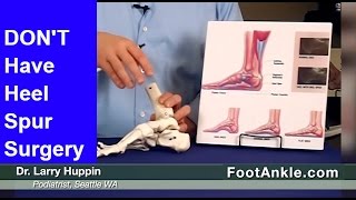 Heel Spur Treatment – How to Avoid Heel Spur Surgery  Seattle Podiatrist [upl. by Teria]