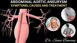 Abdominal Aortic Aneurysm Causes Symptoms and Treatment [upl. by Whetstone]