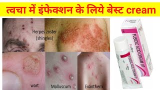 best cream for skin infection  fucidin cream  fucidin cream for acne  fusidic acid cream [upl. by Yalonda]