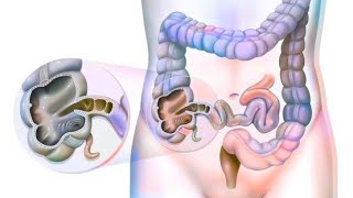 Large intestine  Caecum amp Appendix Part1 [upl. by Leo992]