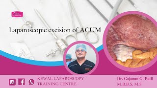 Laparoscopic excision of ACUM Kewal Hospital  Laparoscopy Training [upl. by Jackquelin]