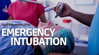 Emergency Intubation RSI in ER step by step approach [upl. by Allegra]