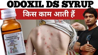 odoxil ds 250 mg syrup uses in hindi  odoxil ds 250 mg syrup uses in hindi  odoxil ds syrup [upl. by Allemat]