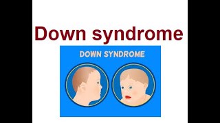 Understanding Down Syndrome Causes amp Treatments  2024 [upl. by Billmyre]