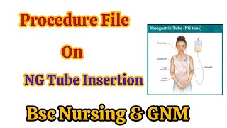 NG Tube Insertion ProcedureProcedure On NGTube Insertion proceduredemonstration nursing [upl. by Sianna]