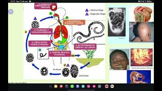 NEMATODOS Enterovius trichuris Ascaris Strongyloides Uncinarias Filariasis Oncocercosisetc💀🧫 [upl. by Tehr]