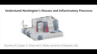 ZEISS ZEN Correlative Array Tomography Understanding Huntingtons Disease [upl. by Ojytteb]