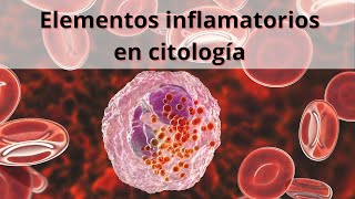 Elementos inflamatorios en citología Glóbulos blancos Leucocitos [upl. by Ardnuasac487]