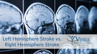 Left Hemisphere Stroke vs Right Hemisphere Stroke  Vibra Rehabilitation Hospital of Amarillo [upl. by Neelhtak]