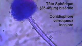 Aspergillus flavus explained [upl. by Tomas]