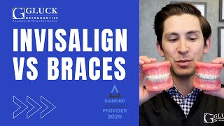 Invisalign vs Braces Tips from a Board Certified Orthodontist [upl. by Eiramacissej]