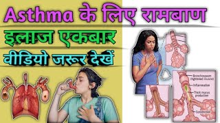 Asthma  What is Asthma  Treatment of asthma [upl. by Navap789]