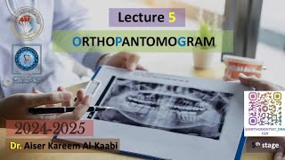 Orthopantomogram OPG lecture 5 2025 [upl. by Sturges]