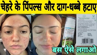 mamaearth bye bye acne face cream review  mamaearth bye bye acne face cream how to use [upl. by Mella470]