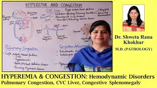 HYPEREMIA amp CONGESTION Pulmonary Congestion  CVC Liver  Congestive Splenomegaly [upl. by Tierney758]