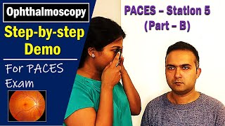 PACES UK Station 5 OphthalmoscopyFundus Exam Stepbystep Howto Guide [upl. by Nahum717]